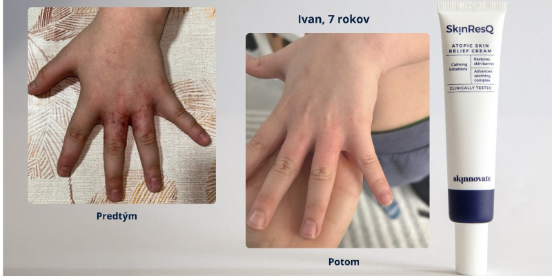 Ivan (7 rokov)